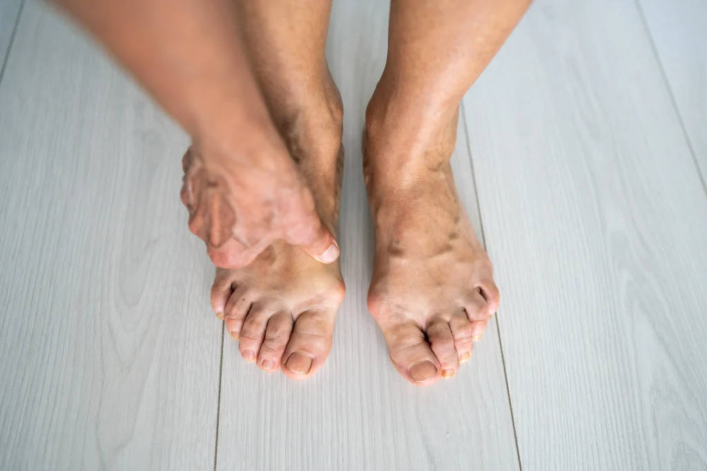 sarokcsontgyulladas sarkantyu terapia24